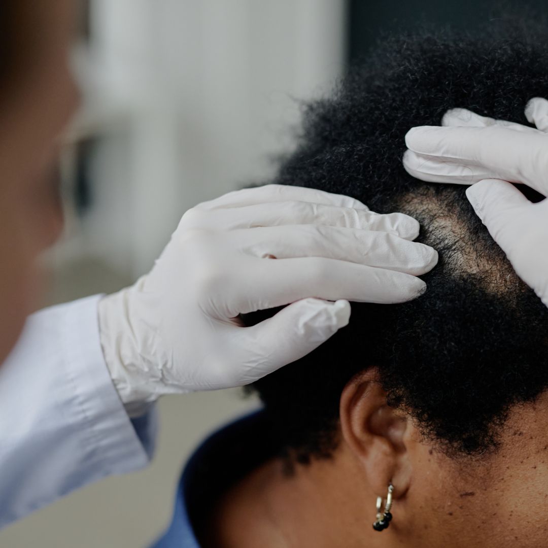 Dry Scalp Care for Textured Hair: What Actually Helps